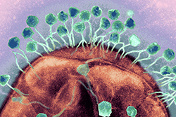 Los bacteriófagos son virus que se adhieren a la superficie de algunas bacterias, les inoculan su material genético y terminan por destruirlas. Están siendo utilizados para el tratamiento experimental de bacterias resistentes a los antibióticos, con prometedores resultados. En lo imagen, un ataque a una bacteria amplificado unas 200 mil veces. Foto: Graham Beards Los bacteriófagos son virus que se adhieren a la superficie de algunas bacterias, les inoculan su material genético y terminan por destruirlas. Están siendo utilizados para el tratamiento experimental de bacterias resistentes a los antibióticos, con prometedores resultados. En lo imagen, un ataque a una bacteria amplificado unas 200 mil veces. Foto: Graham Beards